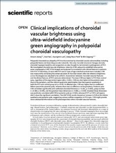 Clinical implications of choroidal vascular brightness using ultra-widefield indocyanine green angiography in polypoidal choroidal vasculopathy