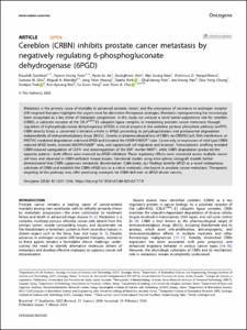 Cereblon (CRBN) inhibits prostate cancer metastasis by negatively regulating 6-phosphogluconate dehydrogenase (6PGD)